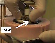 Step 11.1. Post is pushed with right thumb such that ring rotates between 5 and 30 degrees from initial position.