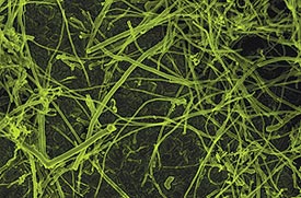 A mass of carbon nanofibers, highlighted in green, are shown in an image from an electron microscope.