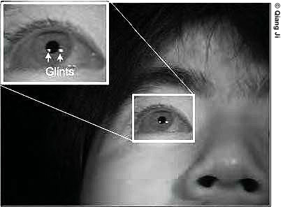 Figure 11. Photo. A close up black and white photo shows a white box highlighting the right eye. This expands to indicate the location of two glints.