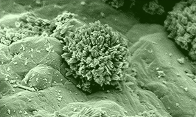 A microscope image of an ettringite mineral