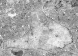   Figure 3-48 (b):  Photographs.  Stereo optical micrographs of A S R gels and reactive coarse aggregates from NC-440-015.  This figure is comprised of two micrographs labeled A and B.  Photograph A is of a large, entrapped air void lined with desiccated ASR gel.  Photograph B is of a granite coarse aggregate that picked up the stain, especially in the cracks within the aggregate.  Also, the rims of the aggregate are visible.  The matching face from this aggregate was prepared in thin section to examine material in the cracks. 