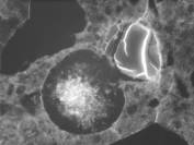  Figure 3-53 (b):  Photographs.  Petrographic micrograph of ettringite intermixed with ASR gel.  As in Figure 3-52, the ASR "gel" in this image is birefringent and crystalline.  This figure is comprised of three micrographs labeled A, B, and C.  Photograph A uses a transmitted plane polarized light.  The ettringite filled air void appears as a light gray circle with the ASR gel attached and shaded in a darker gray.  The ettringite is creeping up around the gel.  Photograph B is in epifluorescent mode and appears similar to Photograph A, but slightly darker.  Photograph C uses a transmitted cross polarized light and is very dark, making distinction of the ettringite and the gel almost impossible.