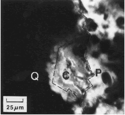 The photo is at high magnification. Paste is seen as cloudy white and approximately 15 by 40 micrometers. A clay pocket bordering the paste particle is a cloudy gray and slightly bigger. Quartz aggregate, seen as black, surrounds both the paste and clay pocket on three sides and covers most of the surface area of the photo. The focus plane is within the section. The reference cited is Walker, 1981