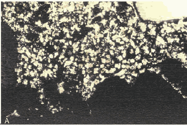 Photo. Thin section of interior portion of H C C: Viewed with crossed nicols (bright area shows the high birefringence of the calcite of the carbonated area).