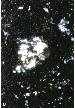 Photo. Same location as figure 161, but viewed with crossed nicols. Note the original birefringence still present in the unhydrated central portion of the large cement grain. 