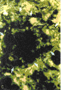 The ultraviolet light causing fluorescence of the dye allows the original external boundary of the cement grain to be seen more clearly.