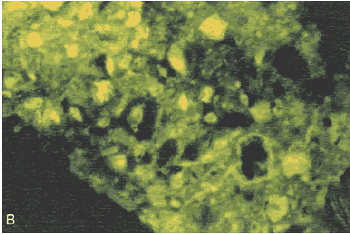 Photo. View of the section in figure 164 with incident ultraviolet illumination, causing fluorescence of the dye-filled space.