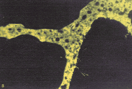 In comparison to this photo, figure 166 has the effect of neutralizing the internal fine aggregate texture, but it does add fluorescence in the pore structure of the paste that is impregnated with dye showing an even texture of the paste with dark specks in a gray matrix