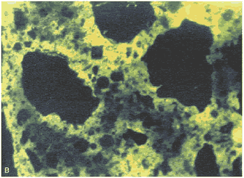With ultraviolet illumination of the same section shown in figure 168, the fluorescence delineates the pore structure in the paste. The clumping of the cement grains, abundance of pores (shown by the fluorescence) at the edge of the sand, structure of the clay coatings, and general uneven texture of the paste are noticeable. Such uneven texture indicates zones of weakness through the H C C. 
