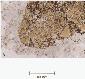 Photo. Thin section of porous, iron-stained particle of sand: Viewed with plane polarized light.