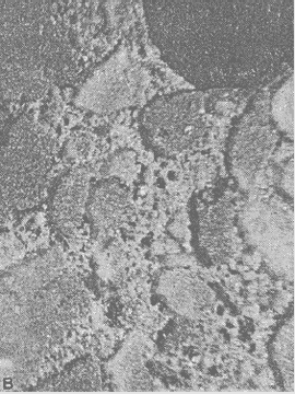 The photo can be compared to figure 68. Again this is a section of the mortar phase of concrete, and it shows the etched surface on a concrete with crushed limestone fine aggregate in which the limestone and paste were cut level. The boundary between limestone and paste is not very clear. The width of the image is 10 millimeters.