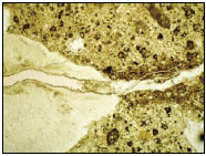 Figure 11. Photo. Example of a Thin Section Sample. This photo shows a microscopic view of a concrete sample, showing the cement paste, a particle of reactive aggregate, and a ribbon of reactive product running through both of them. The crack runs from a point where the gel meets the cement paste and continues parallel to the gel.