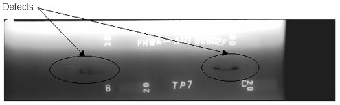 The radiographic image shows two longitudinal discontinuities. One discontinuity is located between markers A (not shown) and B while the other discontinuity is located between markers B and C. The discontinuities are circled for illustrative purposes.