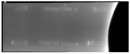 The radiographic image does not show any discontinuities between markers C and D.