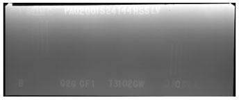 The radiographic image does not show any discontinuities between markers B and C.