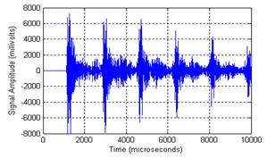 This graph shows acoustic signals recorded on a single wire by the R3I sensor in the baseline condition. Signal amplitude is on the y-axis from -8,000 to 8,000 mV, and time is on the x-axis from 0 to 10,000 ms. This signal looks like a random signal with six spikes, which correspond to the arrival time of the waves reflected by the ends of the wire. The amplitudes of such spikes decrease with time.  