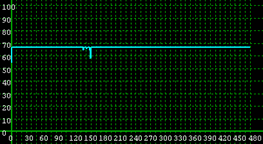 This illustration shows simulated link speed distribution for scenario 6 for the Kennedy Expressway between Pulaski Road and North Cicero Avenue westbound.