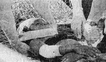 Picture of injured child.